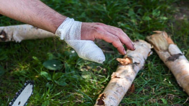 Most Common Chainsaw Injuries: From Cuts to Caution